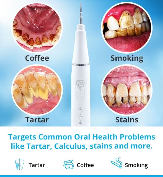 Ultrasonic Deep Clean